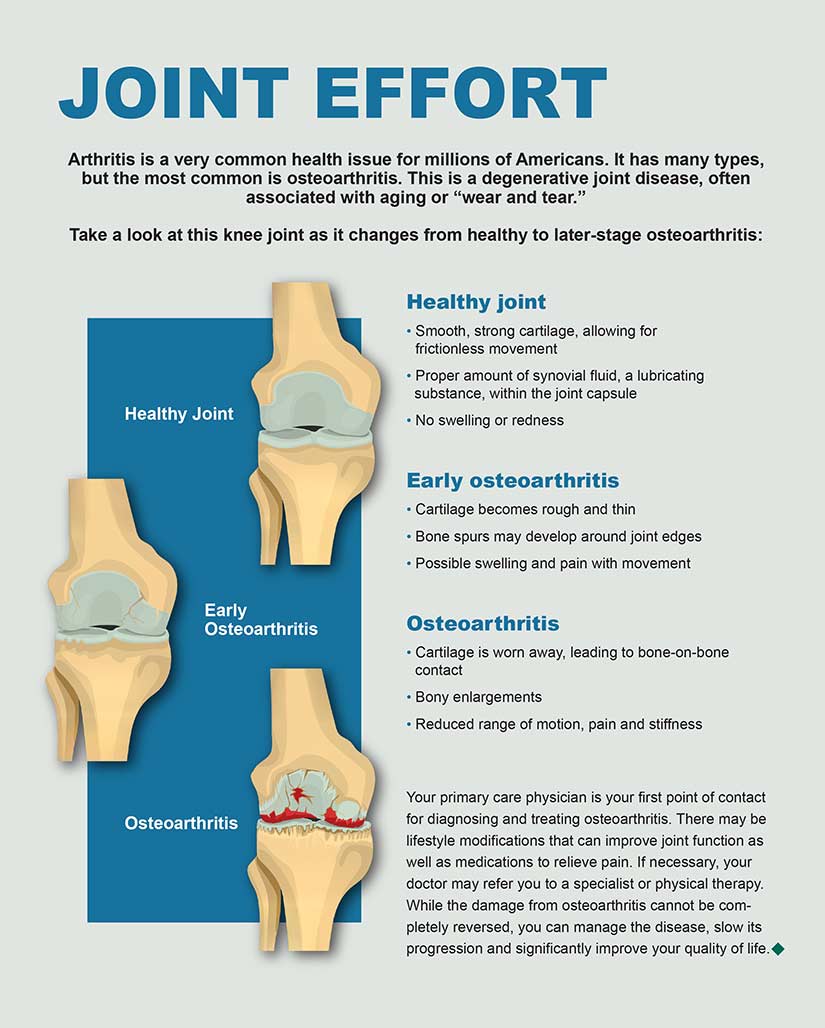 Infographic: Joint Effort