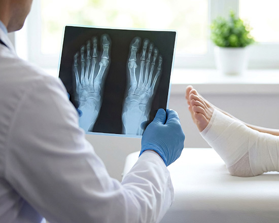 Healthcare provider looking at an xray of an injured foot